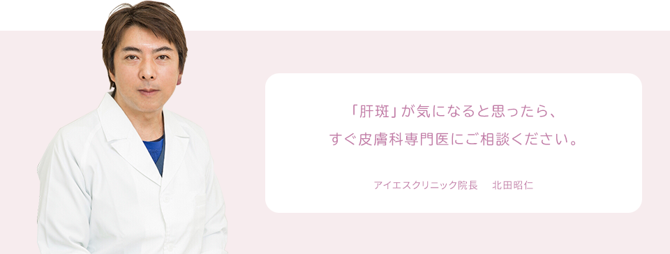 「肝斑」が気になると思ったら、すぐ皮膚科専門医にご相談ください。 アイエスクリニック院長 　北田昭仁