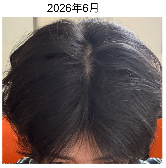 16ヶ月目（2026年6月）の状態