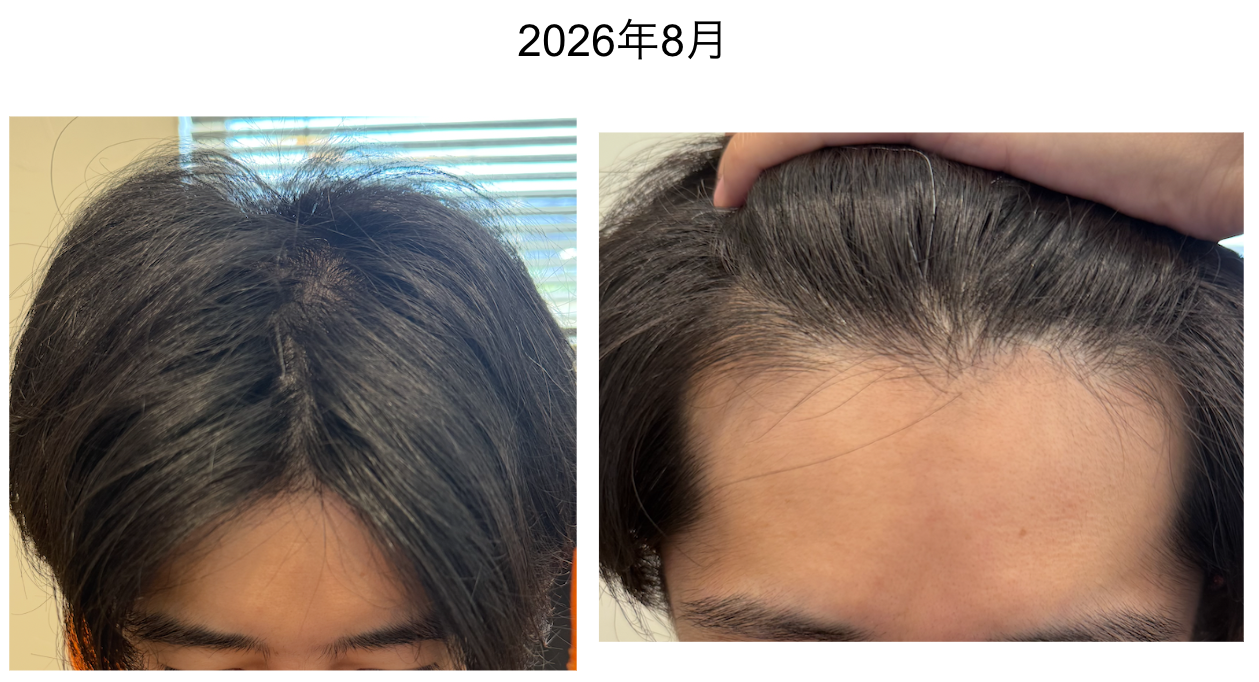 18ヶ月目（2026年8月）の状態