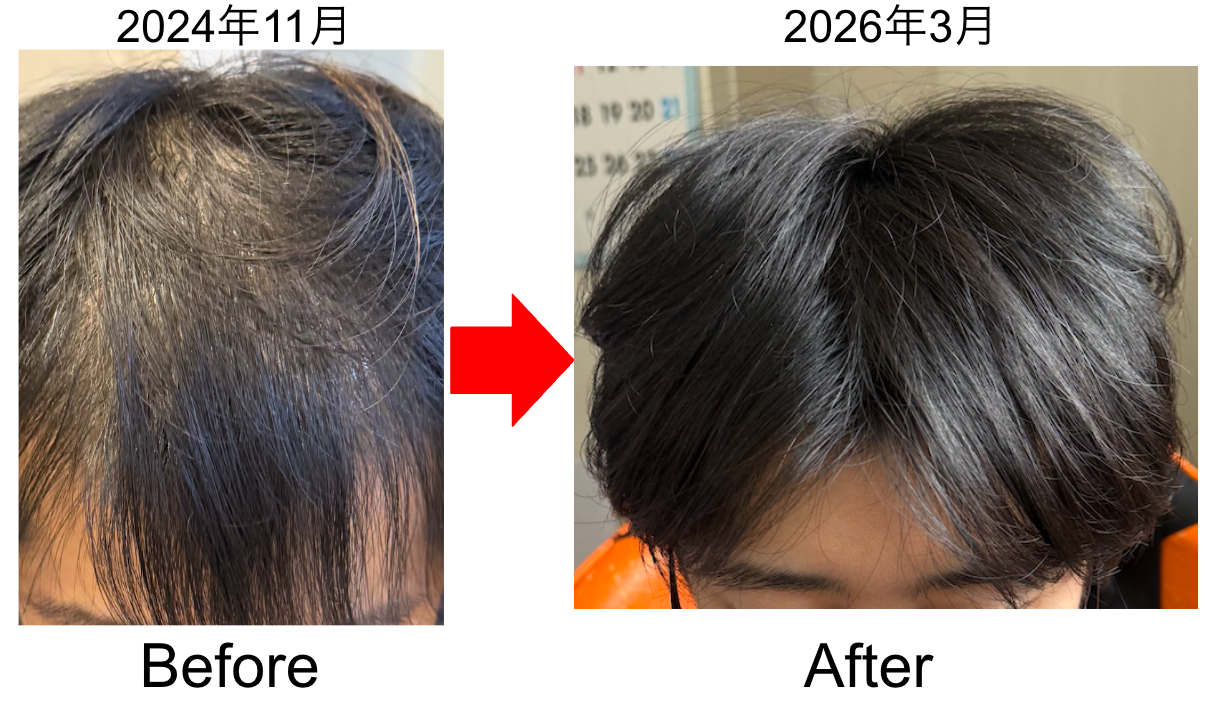 2024年11月と2026年3月の比較